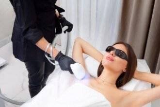 laser hair removal