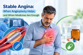 Stable Angina: When Angioplasty Helps, and When Medicines Are Enough